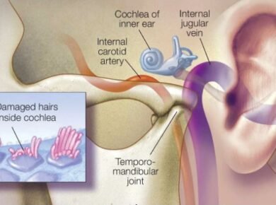 serotonin tinnitus severity study