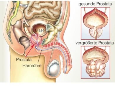 enlarged prostate treatment